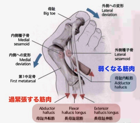 基礎解剖学から考える 外反母趾 Hearts Bridge